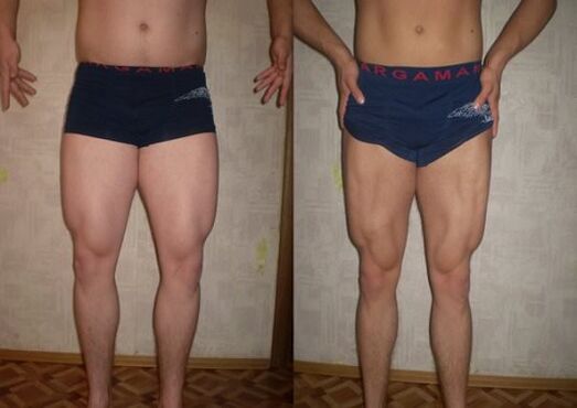 pred in po keto dieti